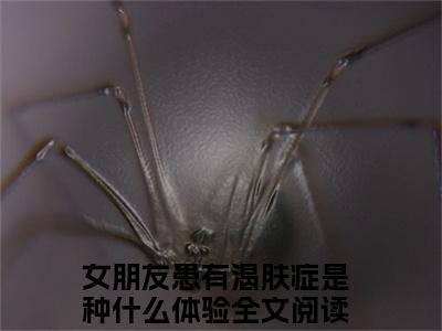 徐柠贺凛（女朋友患有渴肤症是种什么体验）全文无弹窗大结局_徐柠贺凛小说最新章节列表